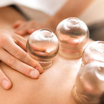 CUPPING 